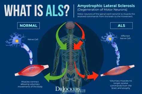 Causes of ALS and motor-neuron disease affecting voluntary muscle control