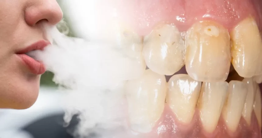 Woman showing tooth damage caused by vaping with visible dark marks on front teeth