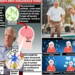 Brain scan showing amyloid buildup linked to Alzheimer's disease