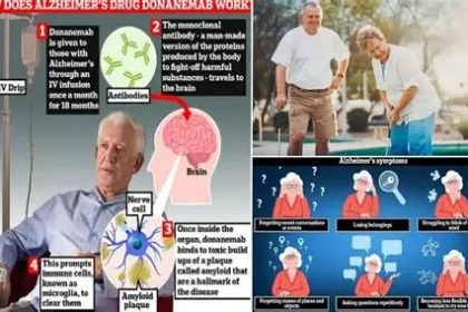 Brain scan showing amyloid buildup linked to Alzheimer's disease