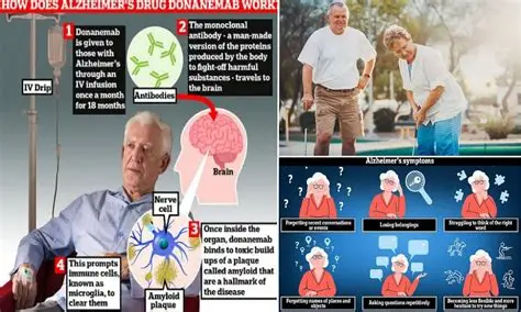 Brain scan showing amyloid buildup linked to Alzheimer's disease