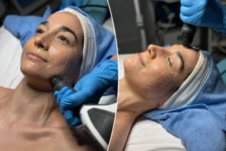 Woman receives salmon sperm DNA skin injection at Seoul aesthetic clinic, close-up on targeted facial treatment.