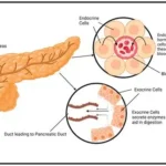 Scientists studying pancreatic cancer cells and damaged mitochondria in laboratory research