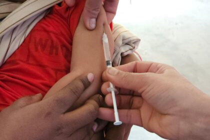 US measles cases reach a 35-year high during the 2026 outbreak
